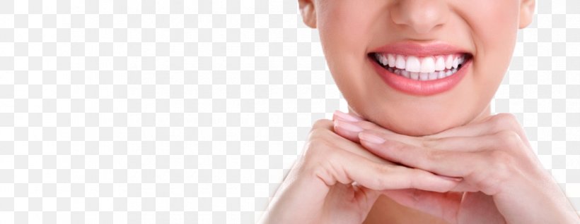 Tooth Whitening Human Tooth Dentistry Smile, PNG, 1170x455px, Tooth Whitening, Arm, Beauty, Cheek, Chin Download Free
