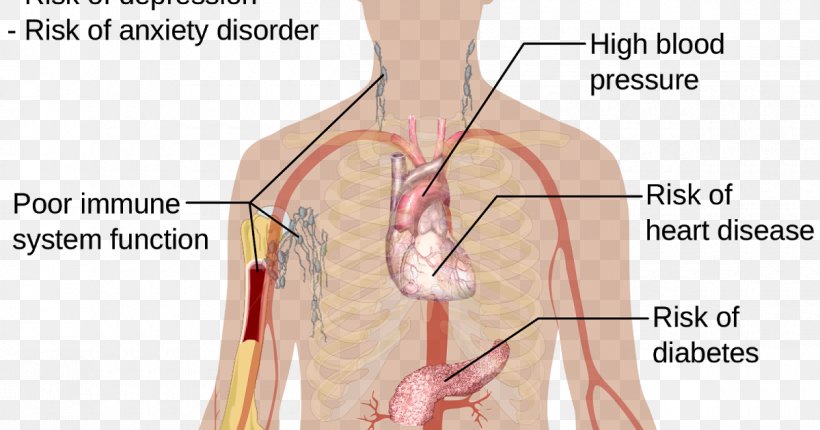 Insomnia Therapy Sleep Acupuncture Medicine, PNG, 1200x630px, Watercolor, Cartoon, Flower, Frame, Heart Download Free