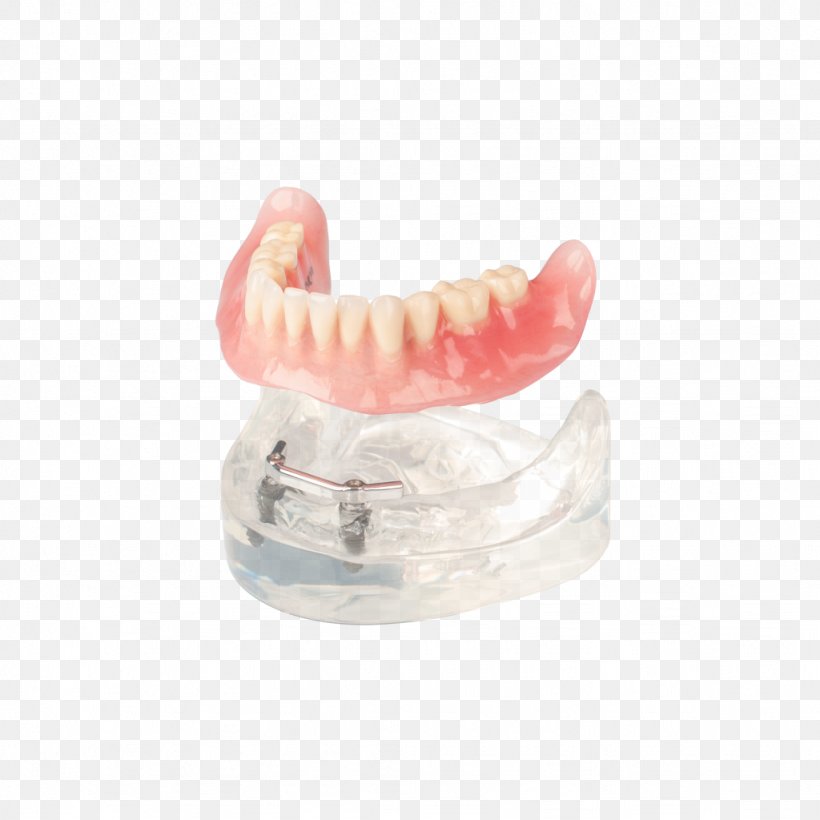 Dentures Tooth Dental Laboratory Dental Implant Dentistry, PNG, 1024x1024px, Dentures, Coupon, Dental Implant, Dental Laboratory, Dentistry Download Free