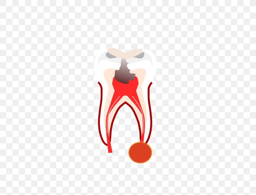Dentistry Root Canal Crown Tooth Dentures, PNG, 500x626px, Watercolor, Cartoon, Flower, Frame, Heart Download Free