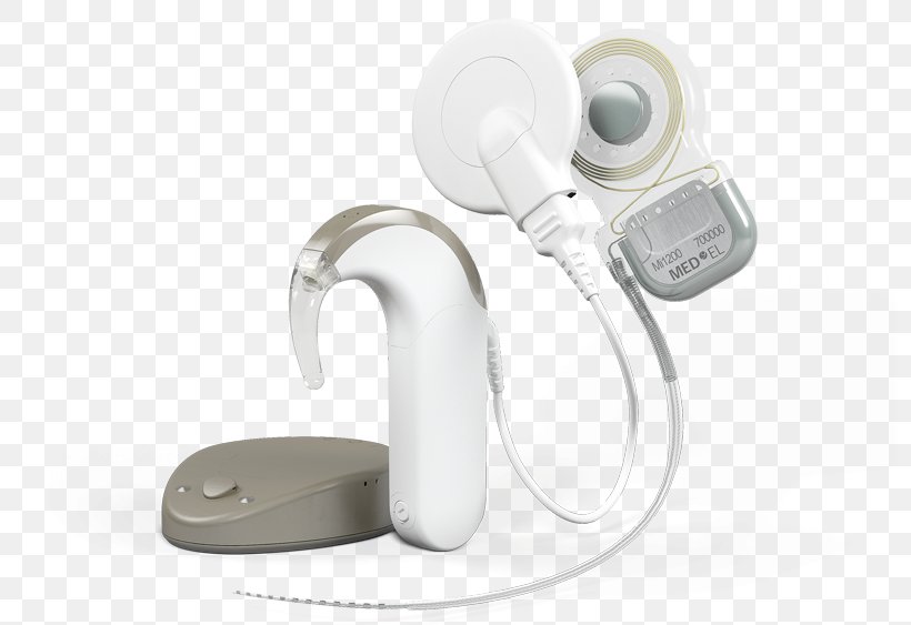 Cochlear Implant MED-EL Sensorineural Hearing Loss Electric Acoustic Stimulation, PNG, 794x563px, Cochlear Implant, Audio, Audio Equipment, Audiology, Boneanchored Hearing Aid Download Free