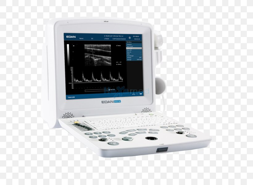 Ultrasound Ultrasonography Ecógrafo Medical Imaging Medical Equipment, PNG, 600x600px, Ultrasound, Cardiology, Diagnostic Ultrasound, Display Device, Doppler Ultrasonography Download Free