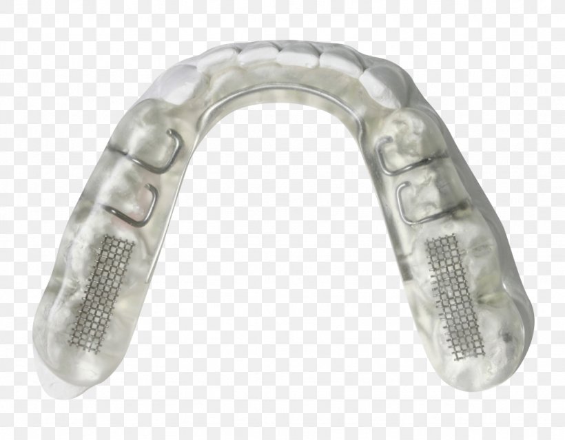 Temporomandibular Joint Dysfunction Splint Orthodontics Dentistry, PNG, 1024x799px, Temporomandibular Joint Dysfunction, Body Jewelry, Breathing, Bruxism, Clear Aligners Download Free