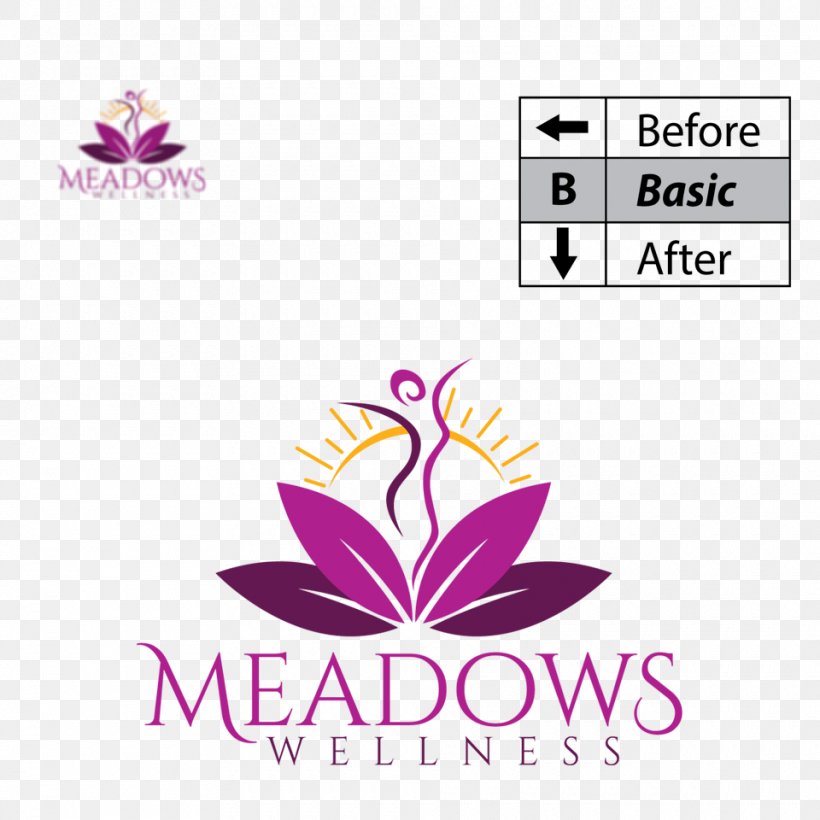 Meadows Wellness Beauty Parlour Abdomen Laser Hair Removal, PNG, 960x960px, Beauty Parlour, Abdomen, Area, Brand, Diagram Download Free