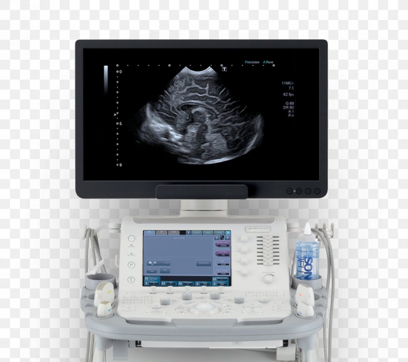 Medical Equipment Ultrasonography Medicine Medical Imaging Medical Diagnosis, PNG, 900x800px, Medical Equipment, Angiology, Canon Medical Systems Corporation, Display Device, Electronics Download Free