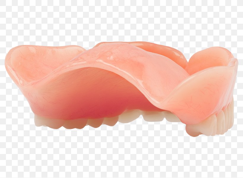 Mouth Dentures, PNG, 800x601px, Mouth, Dentures, Jaw, Lip, Peach Download Free