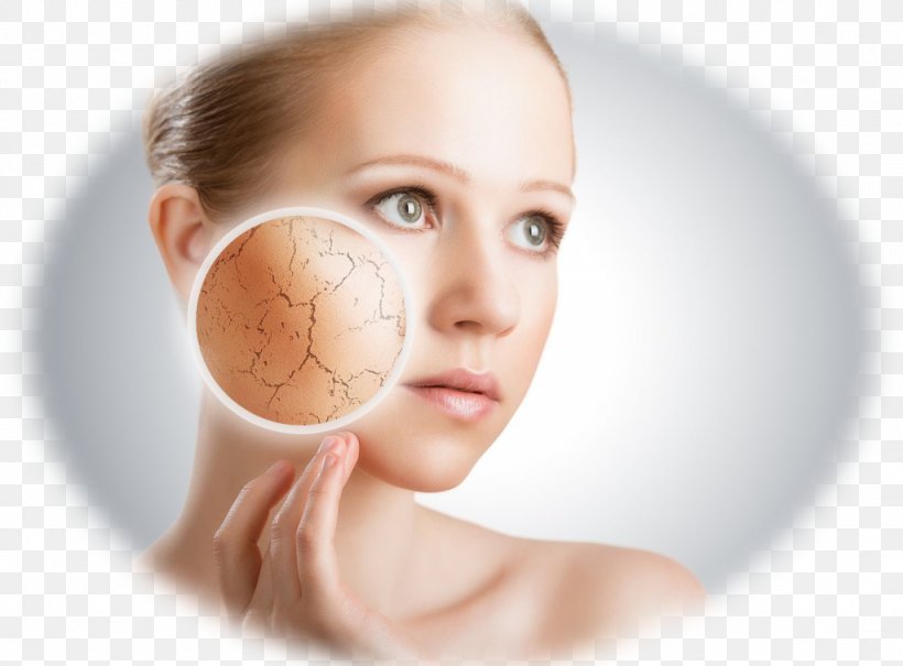 Cosmetics Dermatology Sunscreen Lotion Medicine, PNG, 1024x756px, Cosmetics, Beauty, Cheek, Chin, Dermatology Download Free