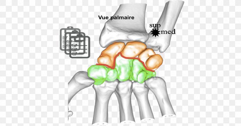 Thumb Carpal Bones Arthrology Wrist, PNG, 1200x628px, Watercolor, Cartoon, Flower, Frame, Heart Download Free