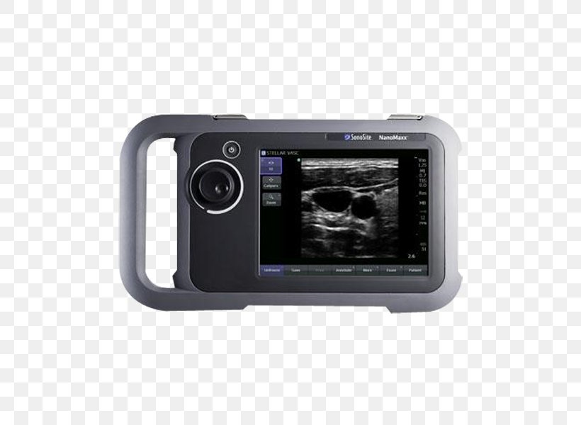 Ultrasonography Ultrasound Ecógrafo Medicine SonoSite, Inc., PNG, 600x600px, Ultrasonography, Bildgebendes Verfahren, Camera, Cameras Optics, Computer Download Free