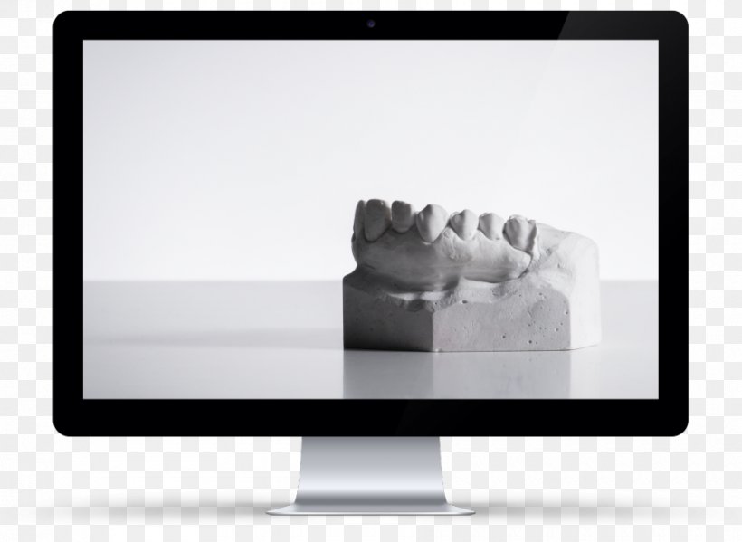 Computer Monitors IMac Cosmetic Dentistry Veneer Tooth Whitening, PNG, 900x658px, Computer Monitors, Aesthetics, Brand, Computer Monitor, Cosmetic Dentistry Download Free