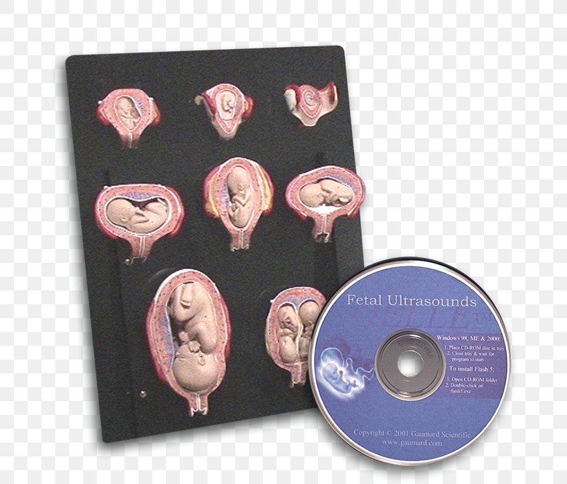Intra-uterine Development Uterus Childbirth Infant Postpartum Period, PNG, 700x700px, Uterus, Cervix, Childbirth, Dvd, Infant Download Free