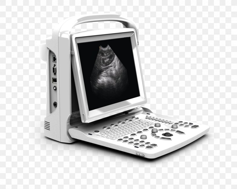 Ultrasonography Portable Ultrasound Doppler Echocardiography Medical Imaging, PNG, 1024x819px, Ultrasonography, Ampronix, Communication, Doppler Echocardiography, Doppler Effect Download Free