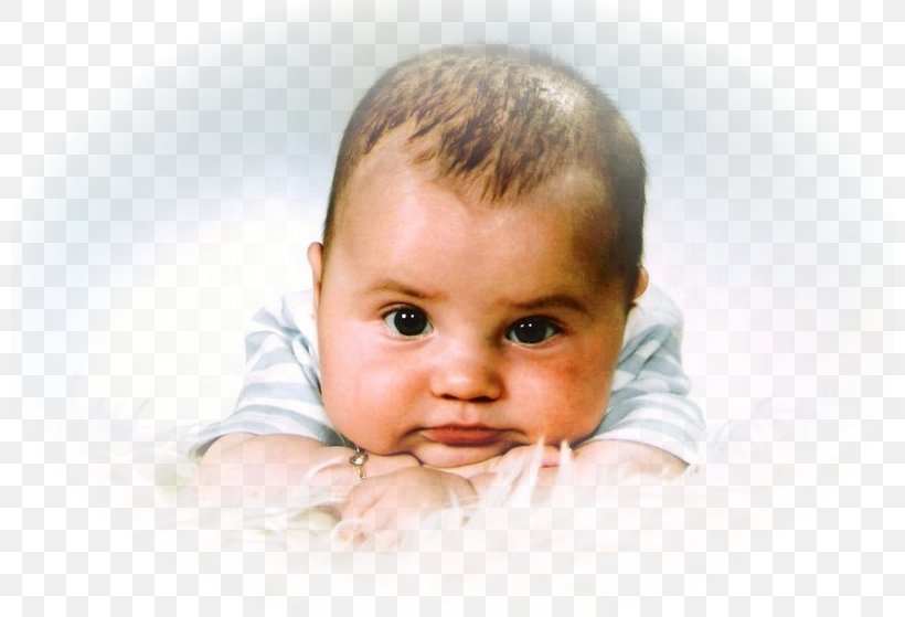 Child Мой сынок Anzhero-Sudzhenskaya Gorodskaya Bol'nitsa Hydrocephalus Infant, PNG, 800x559px, Child, Cheek, Chin, Close Up, Disease Download Free
