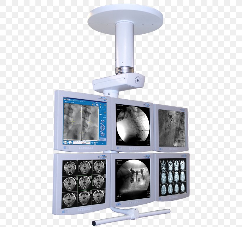 Hybrid Operating Room Surgery Operating Theater Computer Monitors Management, PNG, 484x768px, Hybrid Operating Room, Ceiling, Computer Monitors, Data, Display Device Download Free