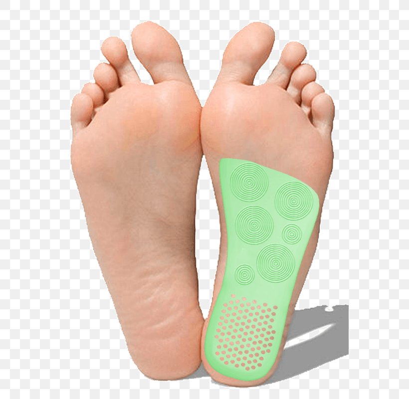 Podalgia Diabetic Foot Flat Feet Skin Ulcer, PNG, 578x800px, Watercolor, Cartoon, Flower, Frame, Heart Download Free