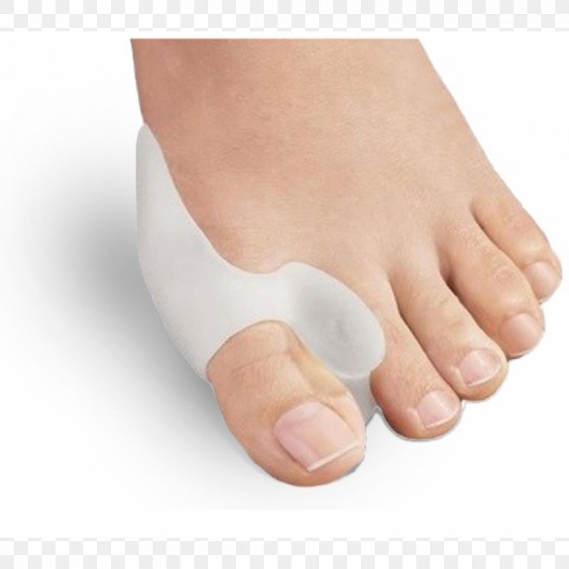 Tailor's Bunion Splint Toe Foot, PNG, 1200x1200px, Watercolor, Cartoon, Flower, Frame, Heart Download Free