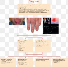 Technetium99m - AL Amyloidosis Familial Amyloid Polyneuropathy Transthyretin Medical Diagnosis PNG