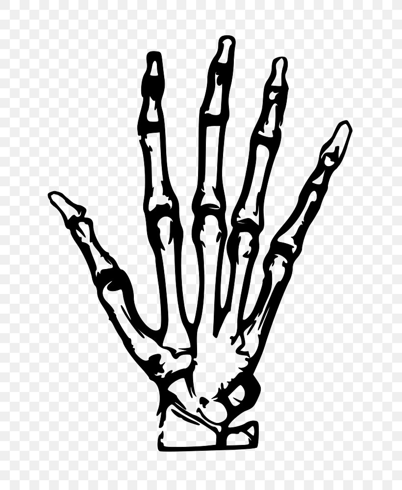X-ray Clip Art, PNG, 707x1000px, Xray, Arm, Black, Black And White, Branch Download Free