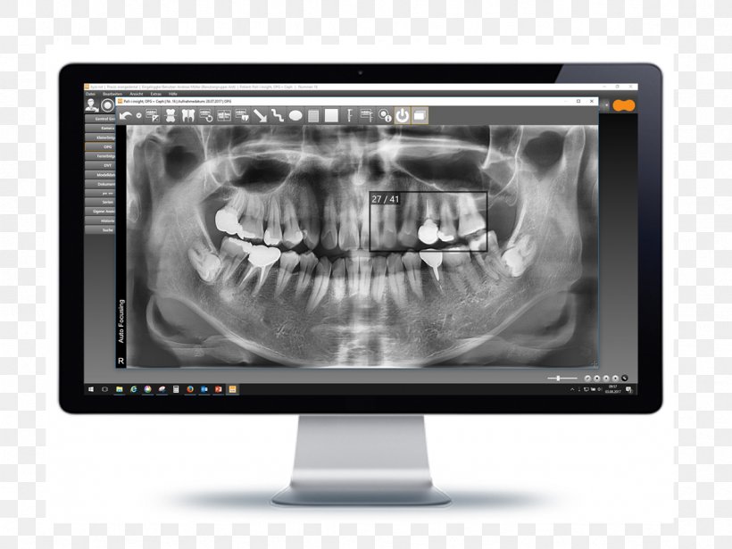 Computer Monitors Medical Imaging Multimedia Product Design, PNG, 1181x886px, Computer Monitors, Brand, Computer Monitor, Display Device, Jaw Download Free