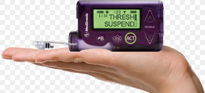 Insulin Pump Diabetes Mellitus Minimed Paradigm Type 1 Diabetes, PNG, 872x396px, Insulin Pump, Artificial Pancreas, Blood Glucose Meters, Blood Glucose Monitoring, Continuous Glucose Monitor Download Free