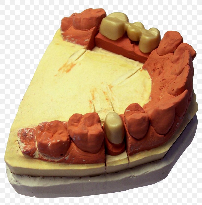 Forensic Dental Evidence: An Investigators Handbook Forensic Dentistry Dental Impression, PNG, 1279x1295px, Dentistry, Buttercream, Cake, Chocolate, Chocolate Cake Download Free