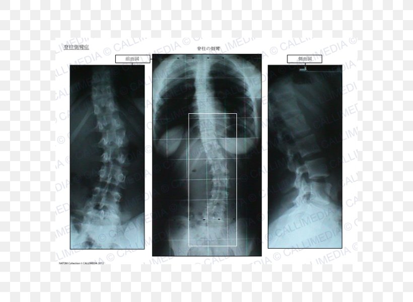X-ray Radiology Medical Imaging Medical Radiography Poster, PNG, 600x600px, Xray, Jaw, Magnetic Resonance Imaging, Medical, Medical Imaging Download Free