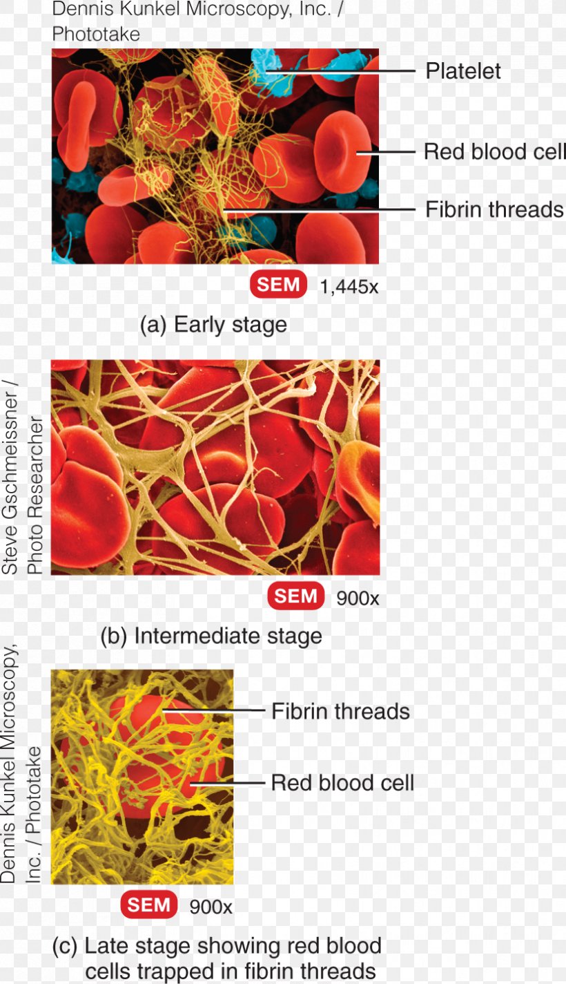 Principles Of Anatomy And Physiology Fibrin Coagulation Blood Thrombus, PNG, 829x1440px, Fibrin, Blood, Blood Cell, Blood Vessel, Brochure Download Free