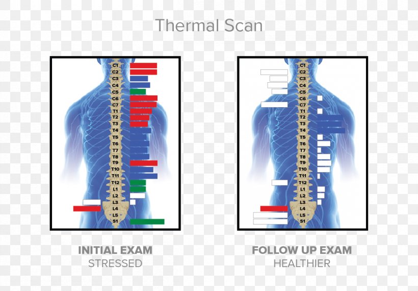 McKillican Chiropractic Chiropractor Nervous System Technology, PNG, 1205x839px, Chiropractor, Adaptation, Brand, Chiropractic, Emotion Download Free