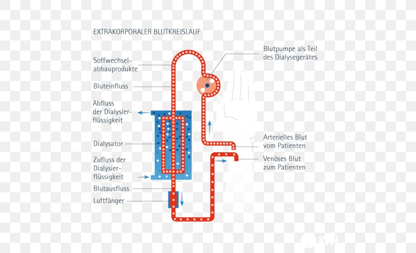 Dialysis Dialysator Blood Medicine Reverse Osmosis, PNG, 535x500px, Dialysis, Area, Blood, Brand, Convection Download Free