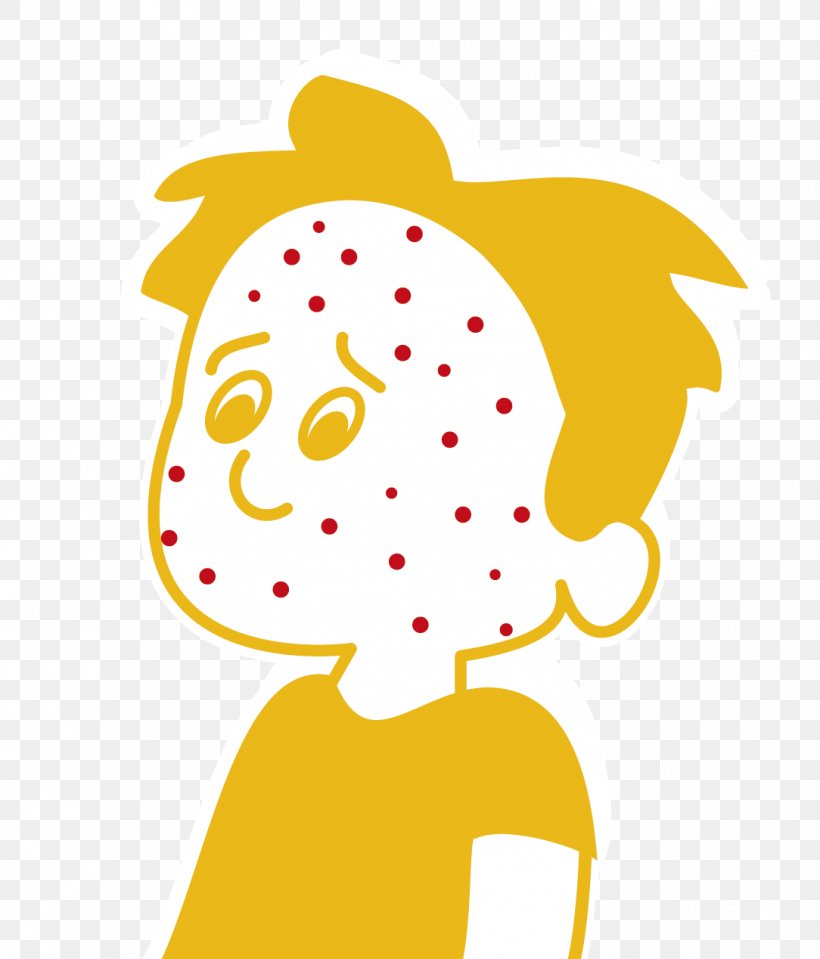 Chickenpox Itch Child Skin Rash Infection, PNG, 1084x1268px, Chickenpox, Amazoncom, Area, Art, Artwork Download Free