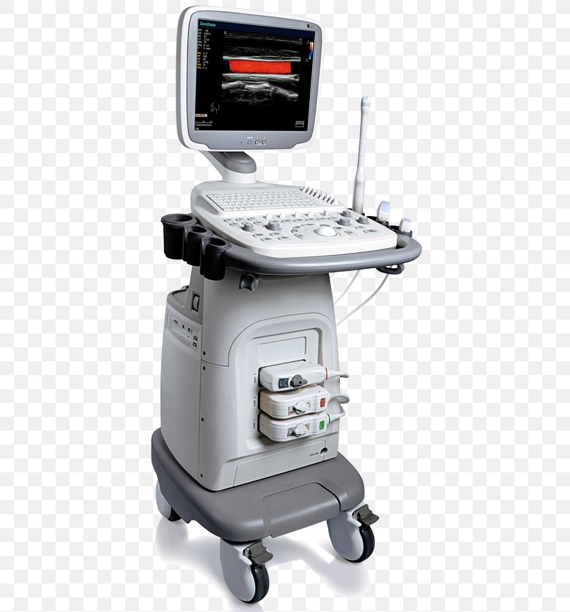 Doppler Echocardiography Ultrasonography Contrast-enhanced Ultrasound Medical Imaging, PNG, 410x881px, Doppler Echocardiography, Contrastenhanced Ultrasound, Doppler Effect, Doppler Fetal Monitor, Doppler Ultrasonography Download Free