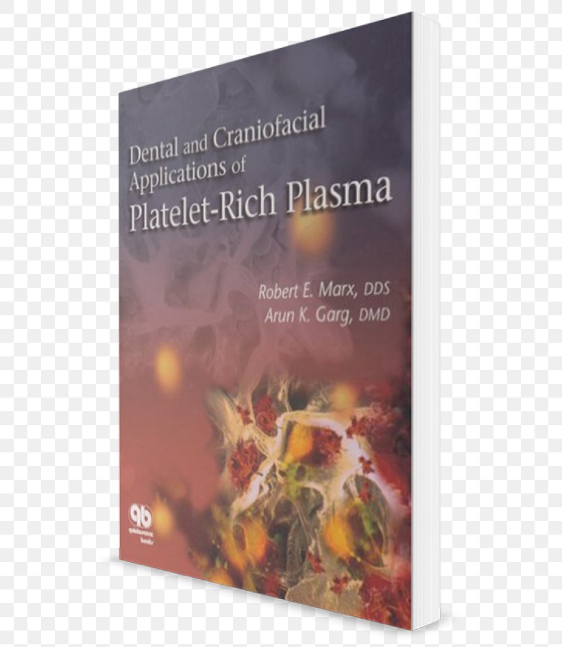 Dental And Craniofacial Applications Of Platelet-rich Plasma Dentistry Blood Plasma, PNG, 750x944px, Plateletrich Plasma, Advertising, Anatomy, Blood Plasma, Craniofacial Download Free