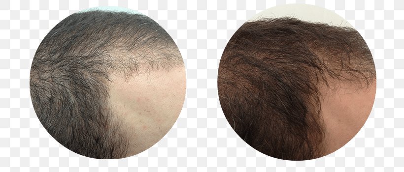 Chin Brown Hair Brush Forehead, PNG, 796x350px, Chin, Brown, Brown Hair, Brush, Ear Download Free