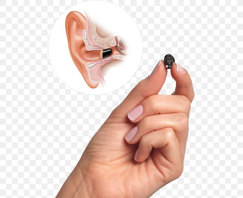 Primary Audiology Hearing Aid, PNG, 495x668px, Audiology, Ear, Earwax, Finger, Hand Download Free
