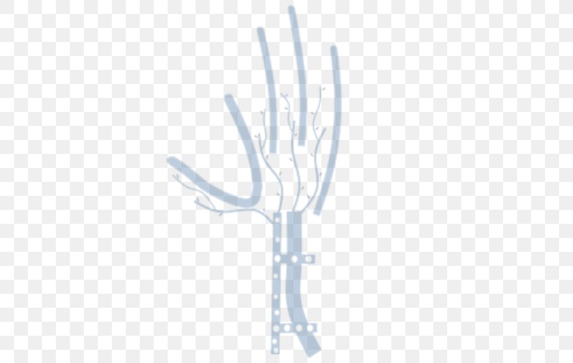 Distal Radius Fracture Wrist Carpal Bones Hand Surgery Bone Fracture, PNG, 608x519px, Watercolor, Cartoon, Flower, Frame, Heart Download Free