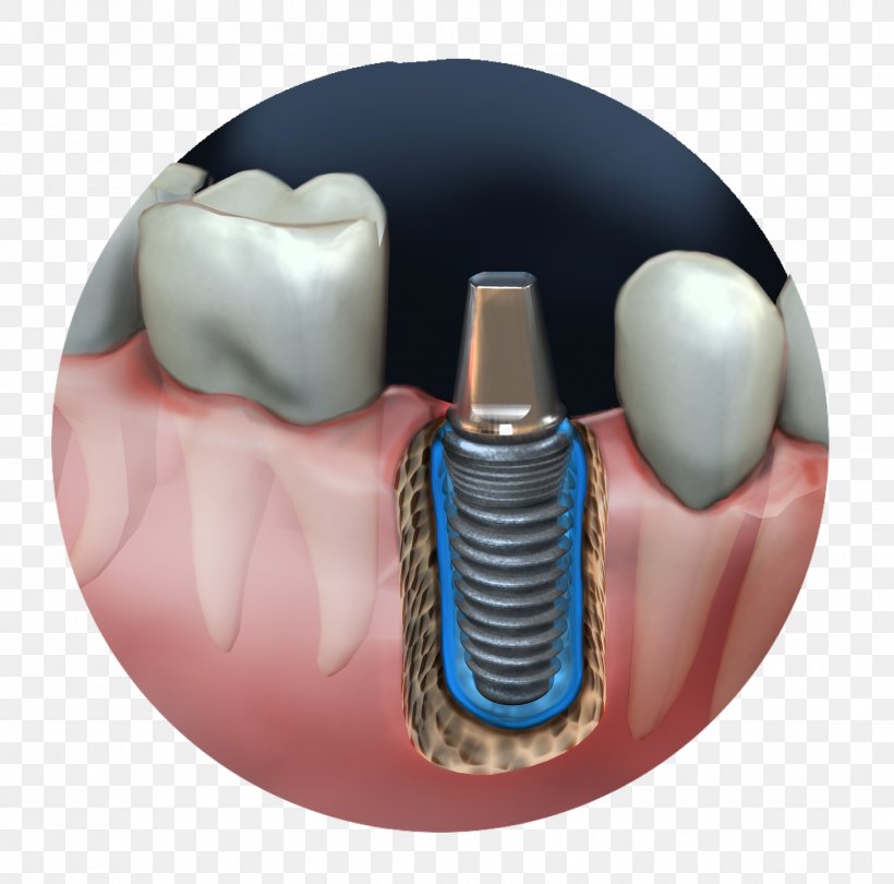 Jaw Medical Illustration Medicine, PNG, 1600x1581px, Jaw, Animated Film, Animation Studio, Company, Human Tooth Download Free