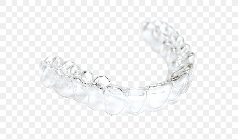 Clear Aligners Dentistry Orthodontics Retainer, PNG, 600x482px, Clear Aligners, Body Jewelry, Bracelet, Cosmetic Dentistry, Dental Braces Download Free