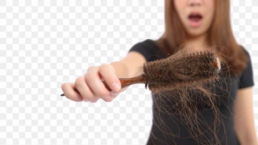 Management Of Hair Loss Hair Transplantation Human Hair Growth, PNG, 1920x1080px, Hair Loss, Arm, Brown Hair, Dandruff, Facial Hair Download Free