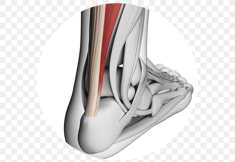 Achilles Tendinitis Achilles Tendon Tendinopathy, PNG, 585x567px, Watercolor, Cartoon, Flower, Frame, Heart Download Free