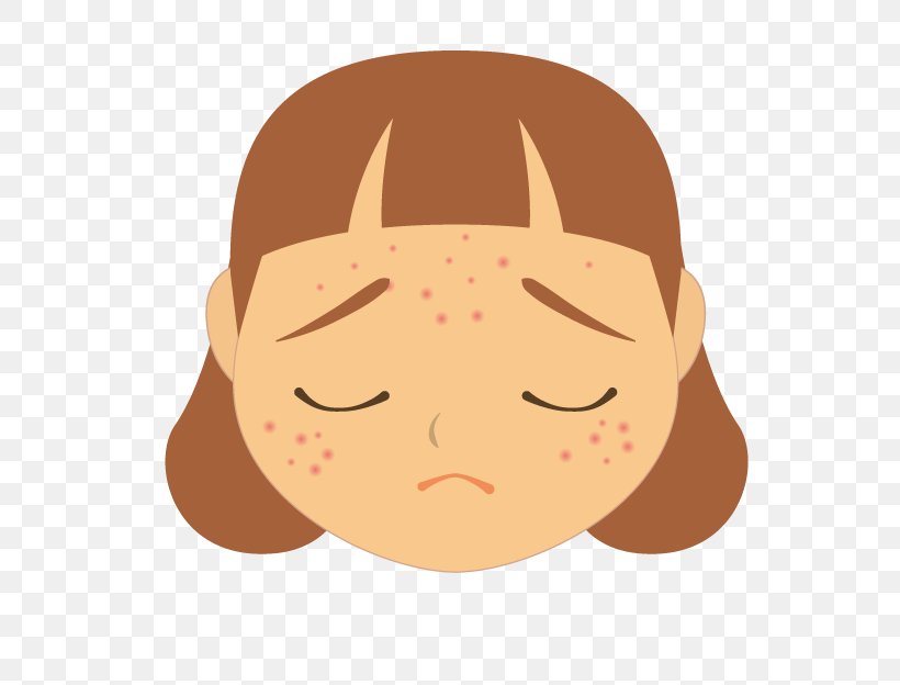Acne Face Dermatology Skin Light Therapy, PNG, 625x624px, Acne, Atopic Dermatitis, Blister, Cartoon, Cheek Download Free