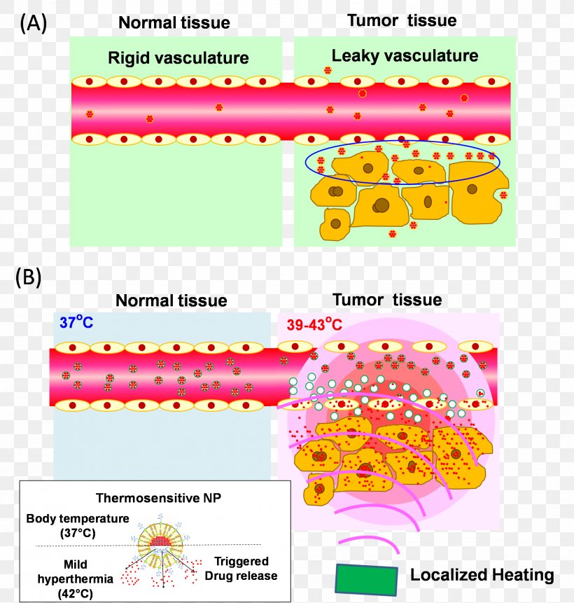 Liposome Drug Delivery Enhanced Permeability And Retention Effect Nanoparticle Pharmaceutical Drug, PNG, 1986x2087px, Liposome, Area, Cytotoxicity, Drug Delivery, Heat Download Free