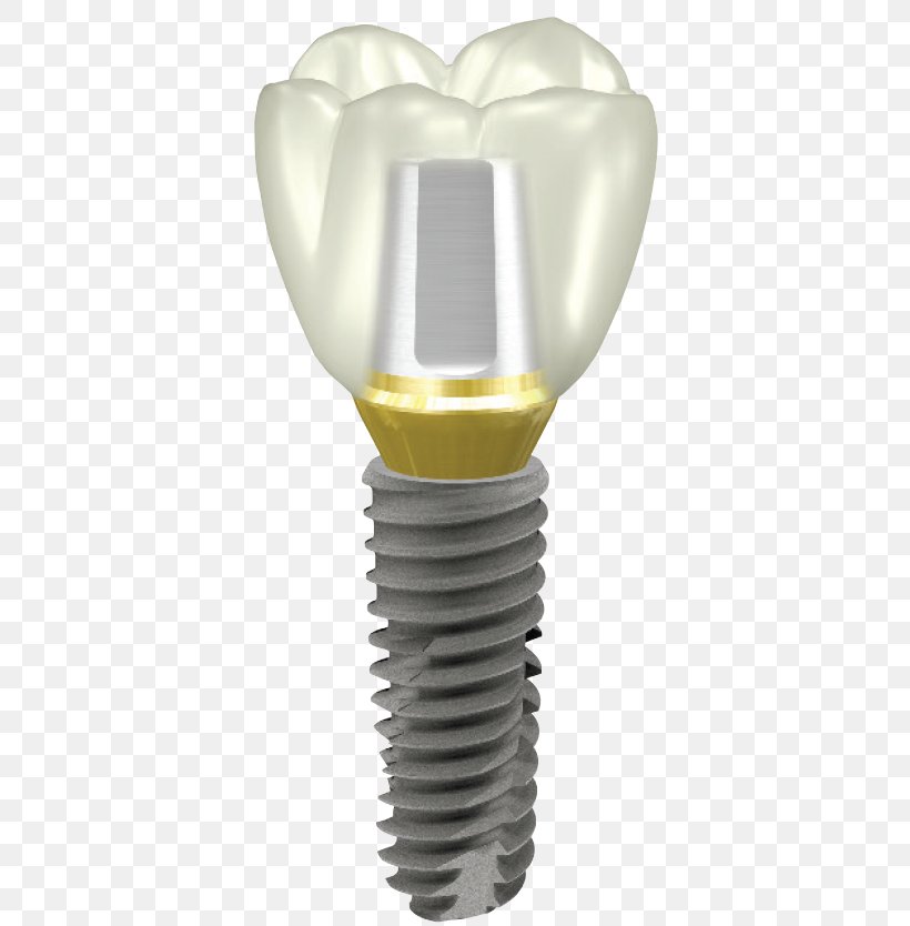 Dental Implant Abutment Dentistry OSSTEM IMPLANT, PNG, 386x834px, Dental Implant, Abutment, Dental Restoration, Dental Tourism, Dentistry Download Free