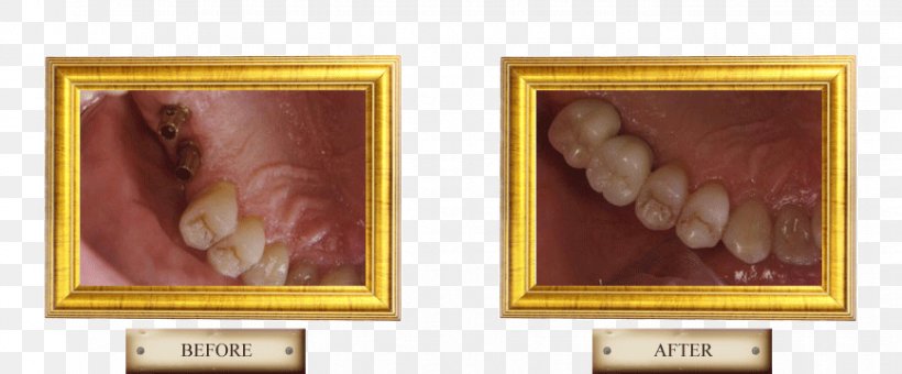 Painting Picture Frames Jaw Image, PNG, 868x360px, Painting, Artwork, Jaw, Picture Frame, Picture Frames Download Free