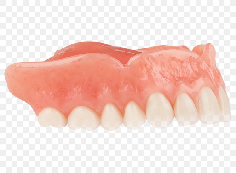 Tooth Dentures Dentistry YouTube, PNG, 800x600px, Tooth, Aspen Dental, Dentistry, Dentures, Heat Download Free