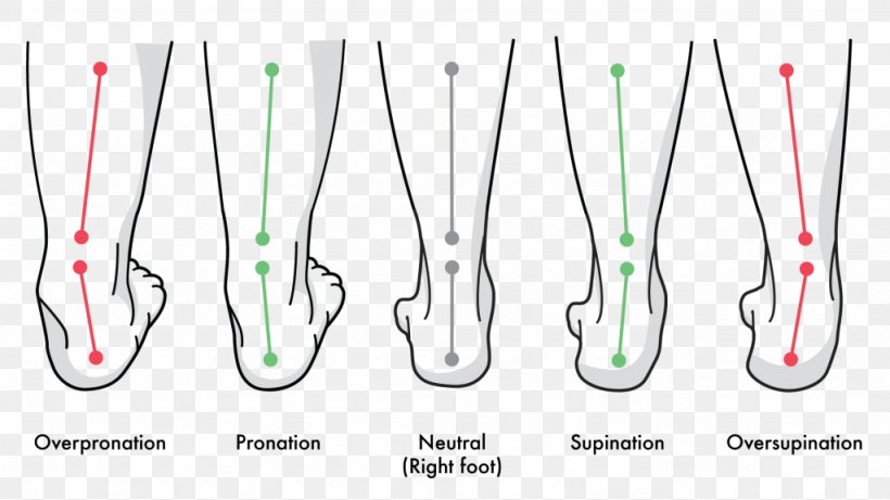 Pronation Of The Foot Supination Gait Achilles Tendinitis, PNG, 1024x576px, Pronation Of The Foot, Achilles Tendinitis, Achilles Tendon, Biomechanics, Flat Feet Download Free