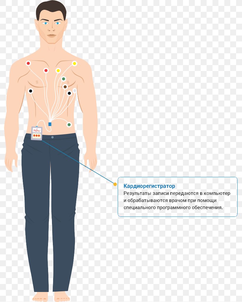 Holter Monitor Hypertension Electrocardiography Cardiovascular Disease Medical Diagnosis, PNG, 791x1021px, Holter Monitor, Abdomen, Arm, Cardiovascular Disease, Cirrhosis Download Free