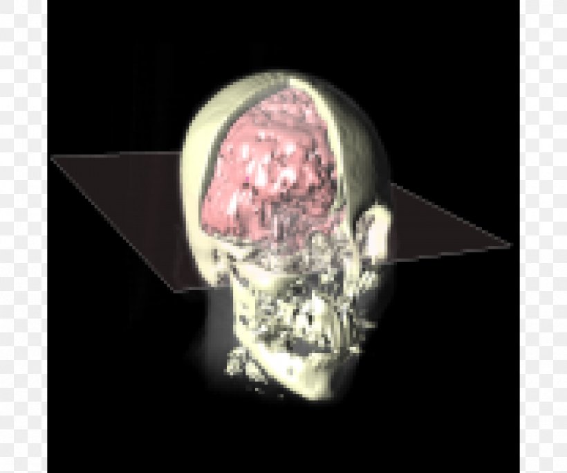 Geometric Modeling Computer-aided Design Computer Graphics Project Differential Geometry, PNG, 1180x983px, Geometric Modeling, Bone, Computer Graphics, Computeraided Design, Data Compression Download Free