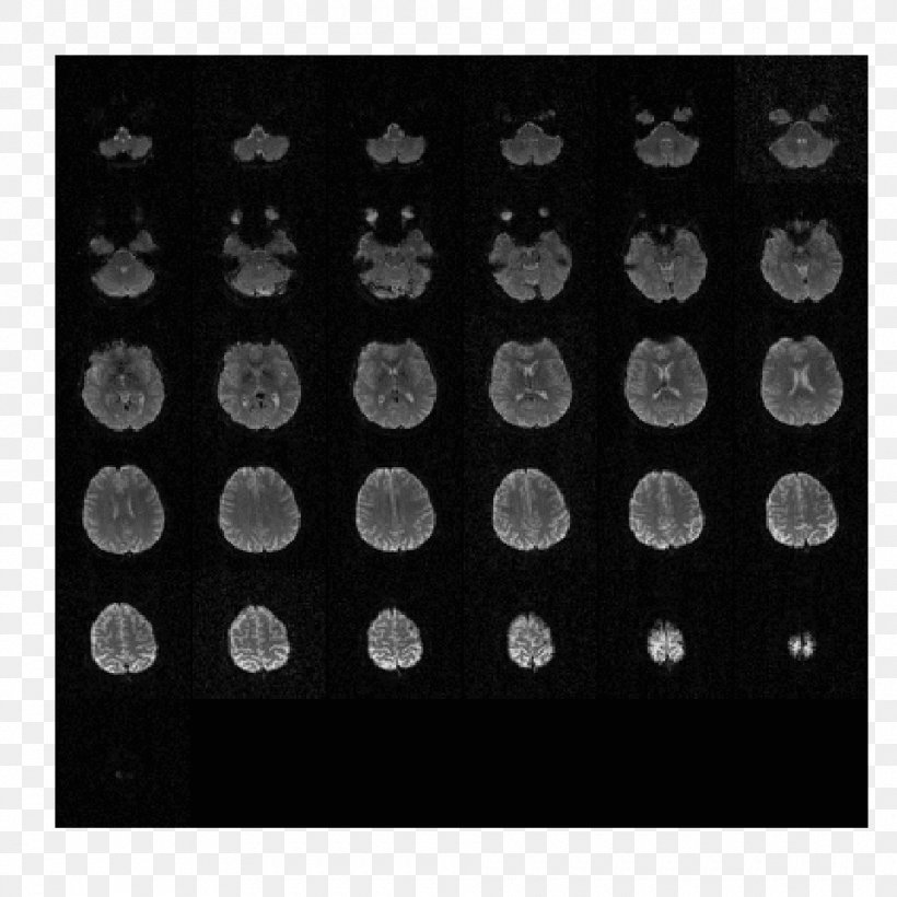 DICOM Single-photon Emission Computed Tomography Magnetic Resonance Imaging, PNG, 960x960px, Dicom, Black, Black And White, Computed Tomography, Cran Download Free