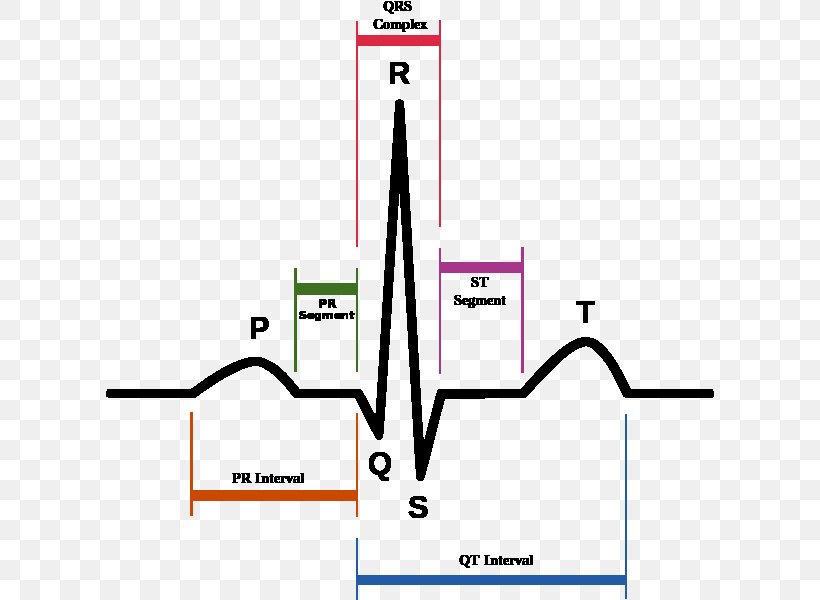 QT Interval Long QT Syndrome PR Interval QRS Complex Electrocardiography, PNG, 608x600px, Qt Interval, Area, Atrioventricular Block, Cardiology, Diagram Download Free