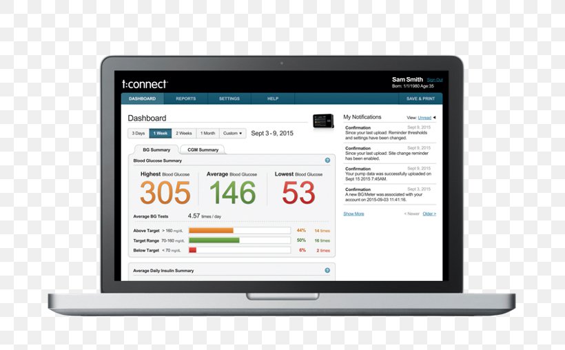 Computer Software Insulin Pump Diabetes Management Software Tandem Diabetes Care, PNG, 737x508px, Computer Software, Brand, Business, Computer, Customer Success Download Free